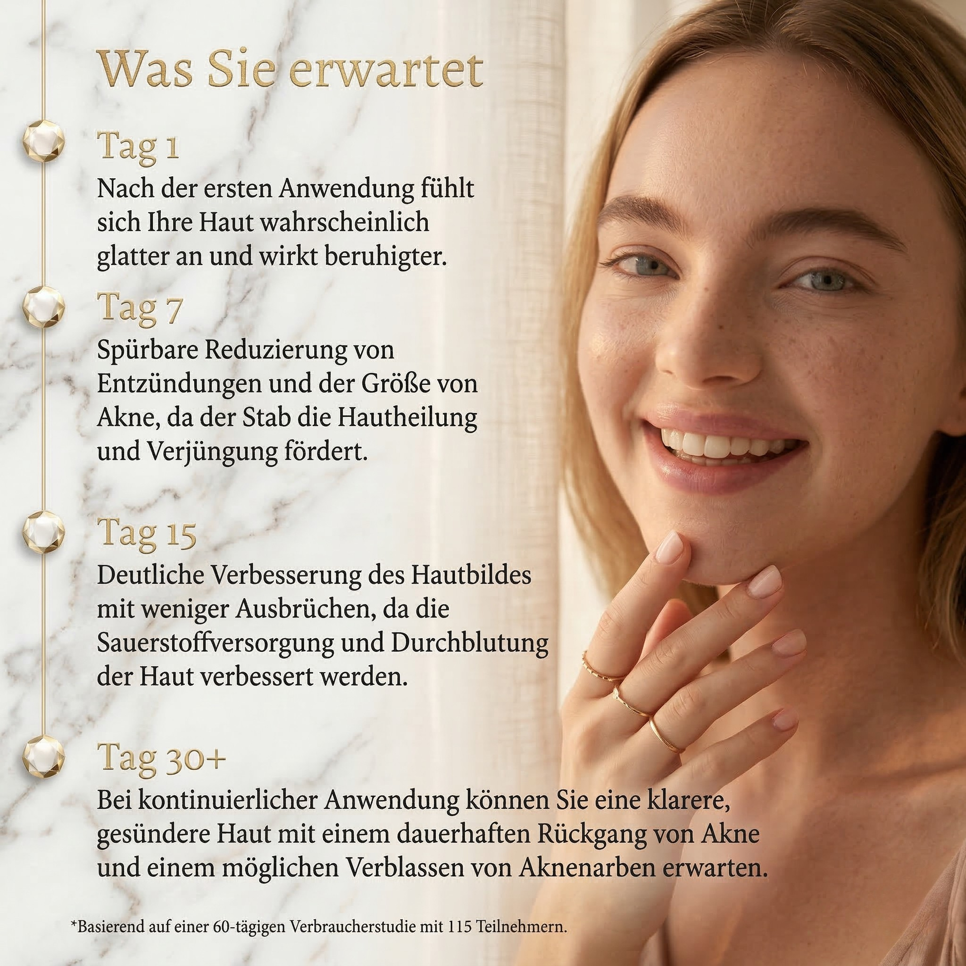 Lanvara Anti-Akne Blaulicht-Gerät für reinere Haut - Bild 5