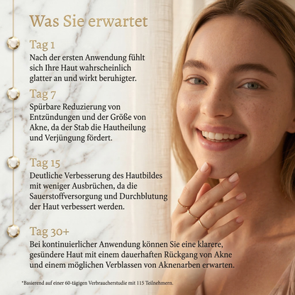 Lanvara Anti-Akne Blaulicht-Gerät für reinere Haut - Bild 5